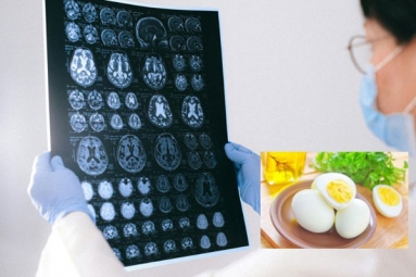 Eggs May Help Prevent Alzheimer&rsquo;s: Study