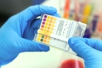 FELUDA test, CRISPR, everything about feluda a low cost covid 19 test in india, Young mind