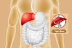 Fatty Liver health, Fatty Liver care, dangers of fatty liver, Activity