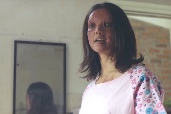 Deepika Padukone's Chhapaak Trailer is Here