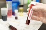 coronavirus, coronavirus, covid 19 vaccine likely by 2021 who, Hydroxychloroquine coronavirus, coronavirus, covid 19 vaccine likely by 2021 who, Hydroxychloroquine